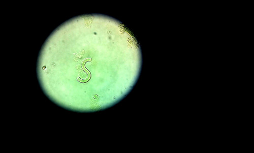 Arthrospira platensis (Spirulina) — photo