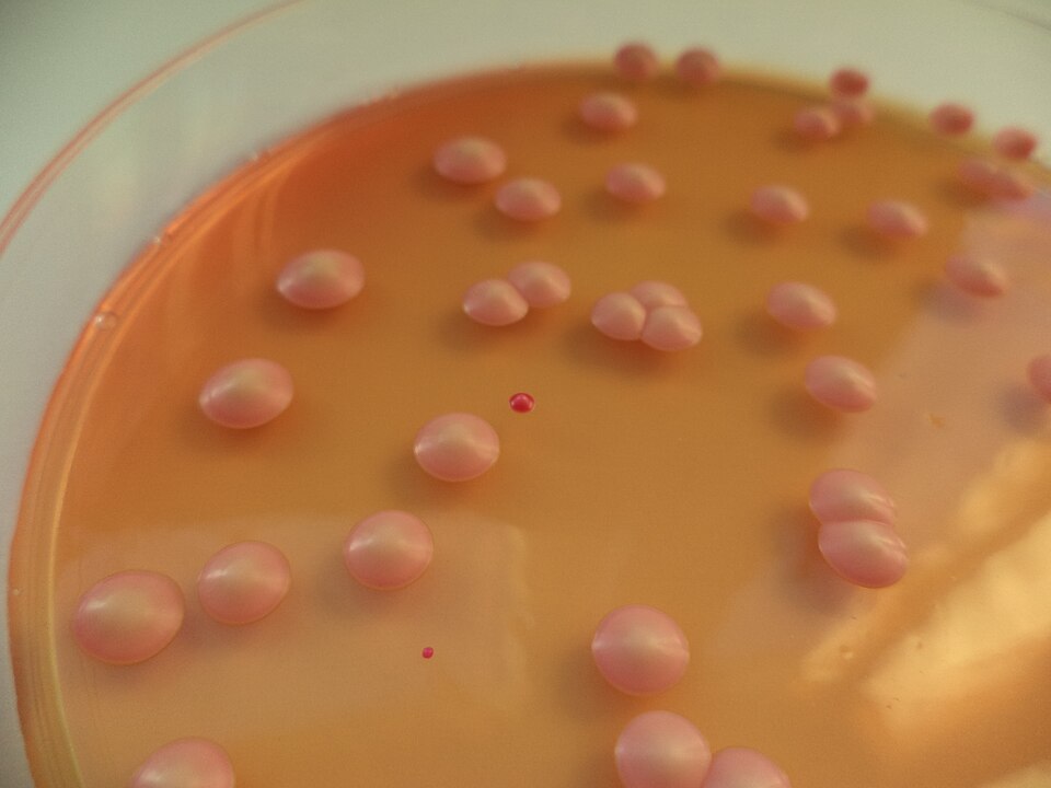 Brettanomyces bruxellensis (Lambic beer yeast) — photo