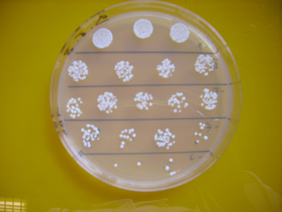 Brettanomyces bruxellensis (Lambic beer yeast) — photo