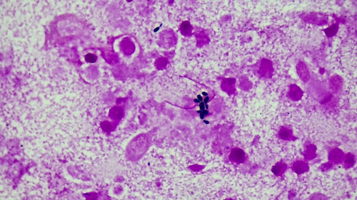 Candida kefyr (Kefir yeast) — photo