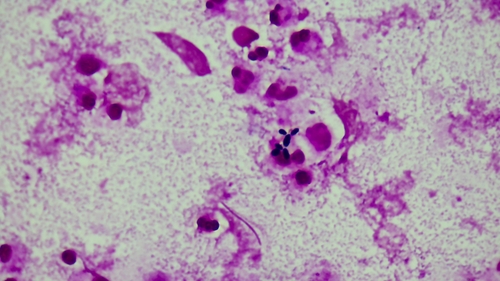 Candida kefyr (Kefir yeast) — photo