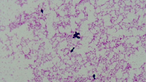 Candida kefyr