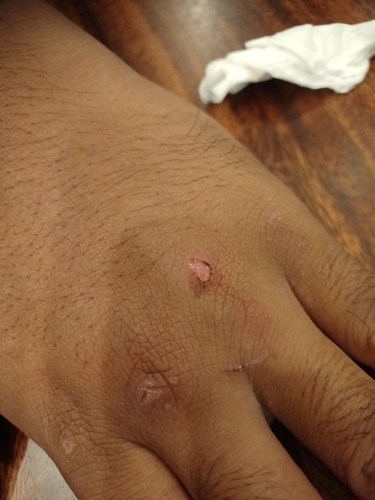 Gluta renghas (Rengas) — photo