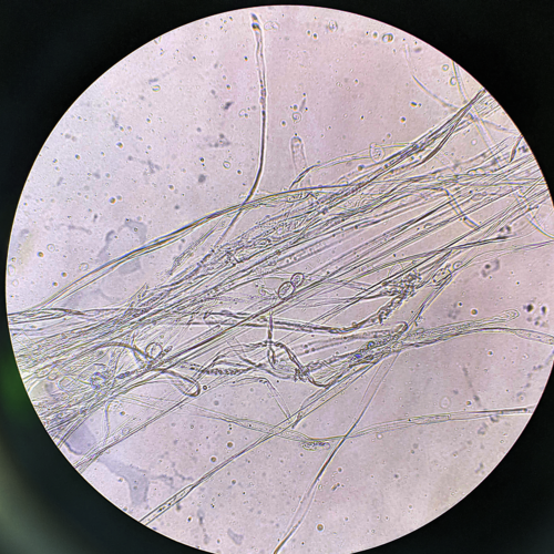 Mucor hiemalis (Sufu mould) — photo