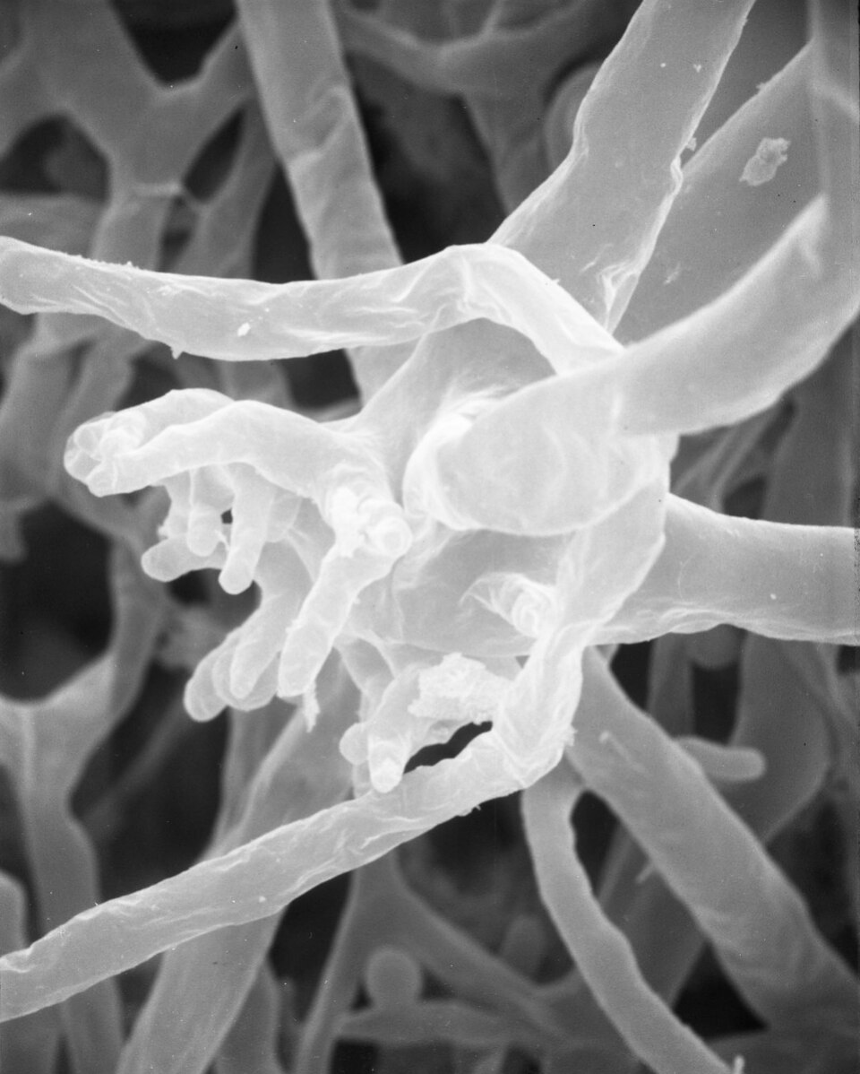 Rhizopus oligosporus