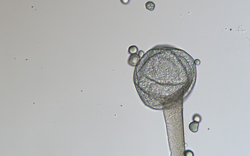 Rhizopus oryzae (Tempeh mould) — photo